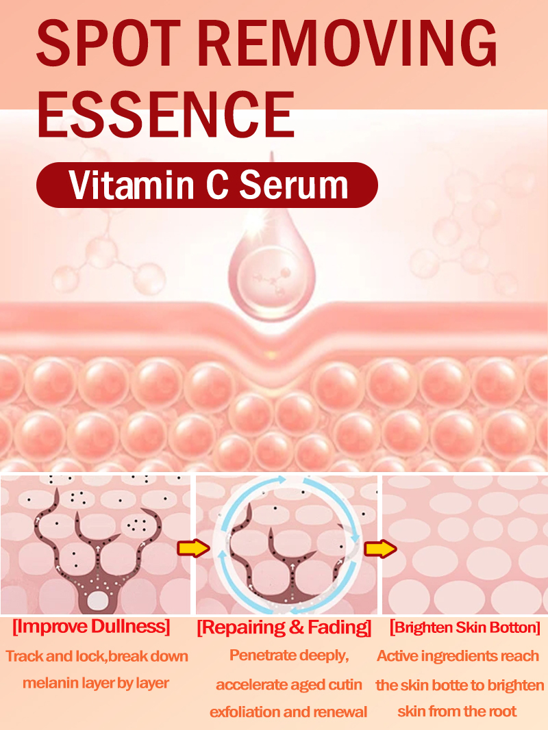 تفتيح النمش الكلف، البقع الداك - مراجعة Luxury Skincare Essence وسعره